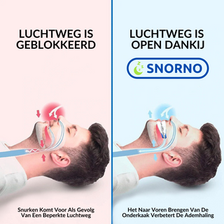 Anti-Snurk Beugel - Gebruiksvriendelijk en Premium Comfort