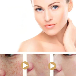 Kurkuma Donkere Vlek Verhelderend Serum