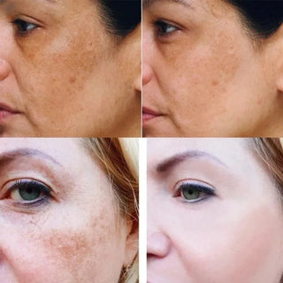 Kurkuma Donkere Vlek Verhelderend Serum
